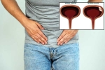 Bladder Cancer experts, Bladder Cancer health checkup, why is bladder cancer common in men, Healthy eating