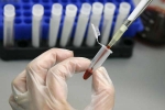 Human Antibodies To Combat Ebola, Ebola Virus, new human antibodies to combat ebola, Ebola outbreak