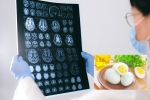 Eggs and Alzheimer’s news, Eggs and Alzheimer’s health benefits, eggs may help prevent alzheimer s study, Alzheimer s