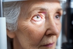 Glaucoma eye disease, Glaucoma doctors, all about the eye disease glaucoma, Eye disease Glaucoma eye disease, Glaucoma doctors, all about the eye disease glaucoma, Eye disease