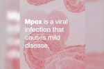 mpox in Sweden, mpox break down, mpox emergency again, Back pain