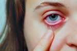 Conjunctivitis latest, Conjunctivitis treatment, special measures to prevent conjunctivitis, Body organs