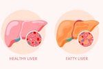 Grade 2 Fatty Liver breaking, Grade 2 Fatty Liver, how to reverse grade 2 fatty liver, Exercise Grade 2 Fatty Liver breaking, Grade 2 Fatty Liver, how to reverse grade 2 fatty liver, Exercise