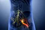 Sciatica nerve disorder, disorder care, help yourself on sciatica, Natural remedies