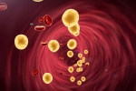 Cholesterol tips, Cholesterol Statins, tips to lower cholesterol when statins don t work, Heart attack
