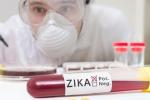 FDA, Food and Drug Administration, fda expands zika screening to all us blood centers, Zika virus